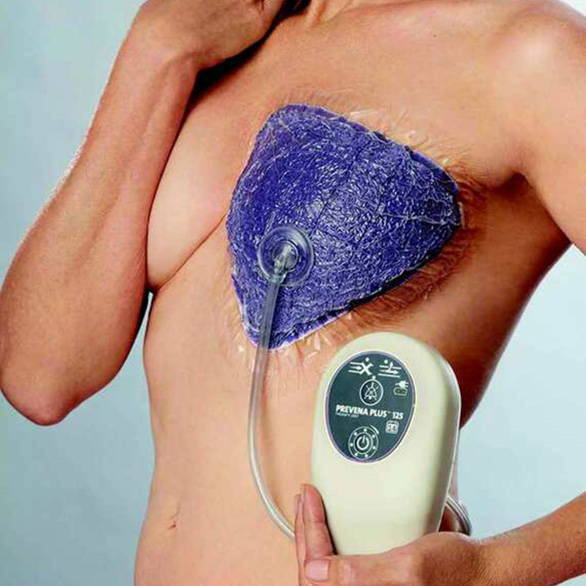 Prevena Restor BellaForm sidos 